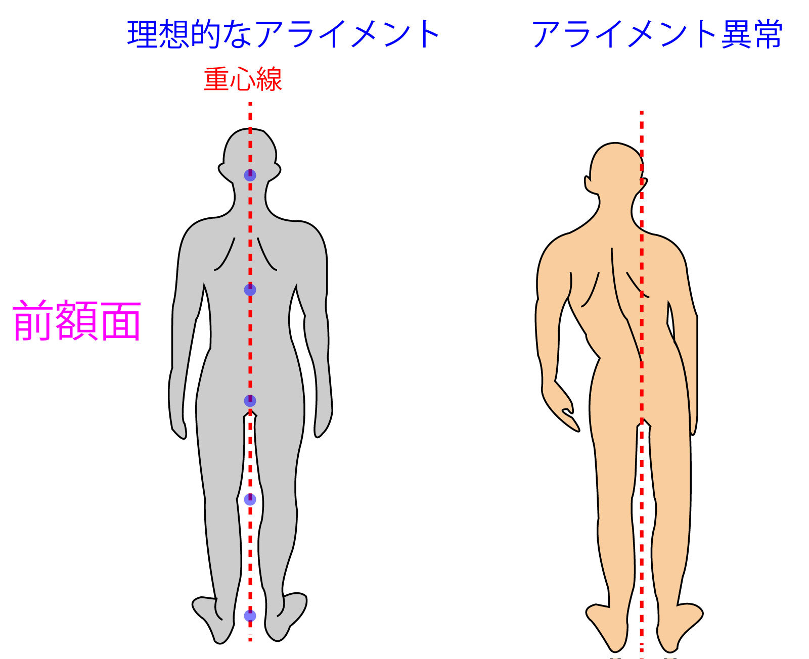 「理想」と「ゆがみ」のイメージ