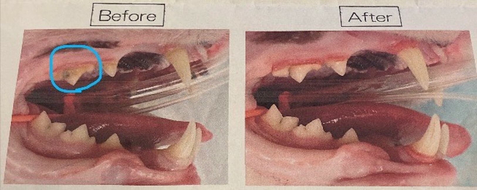 左がBefore 奥歯に歯石がついてますね！Afterはかなり綺麗になってます。