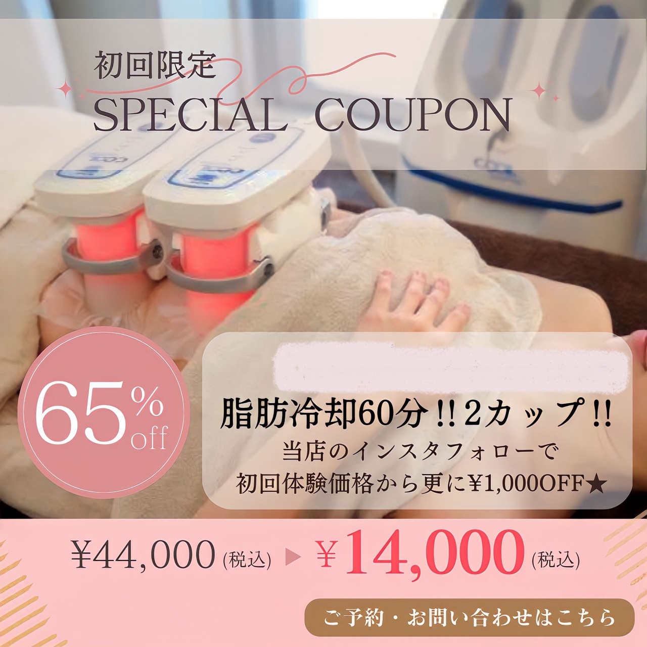 一宮市・栄】一宮初上陸!脂肪冷却痩身とメンズ&キッズ脱毛はココが