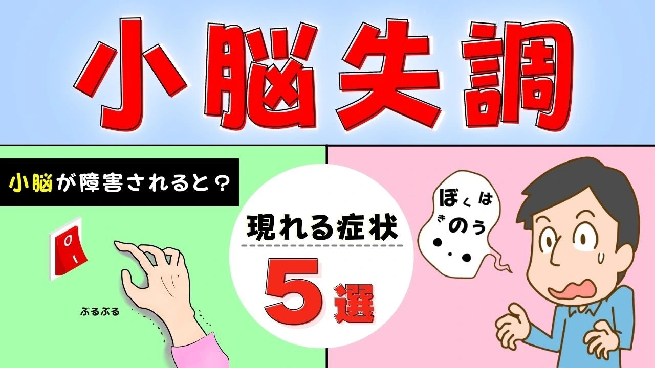 □裁断済 小脳と運動失調 : 小脳はなにをしているのか - 本