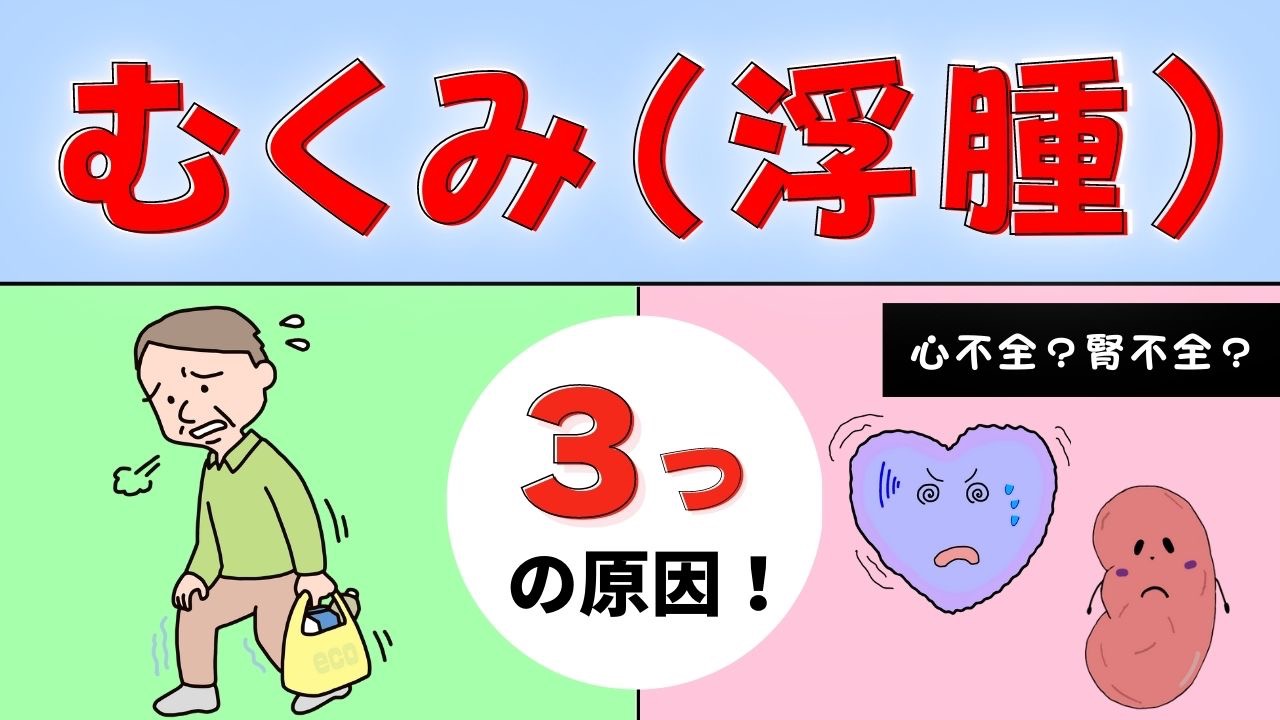 むくみ（浮腫）が起こる３つの原因！】-足がパンパンに