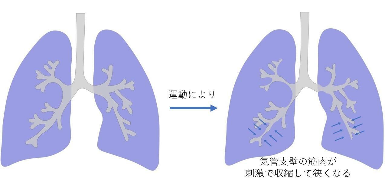 運動誘発性喘息は、冷たくて乾燥した吸気が気管支を刺激して、狭くなってしまう現象です。