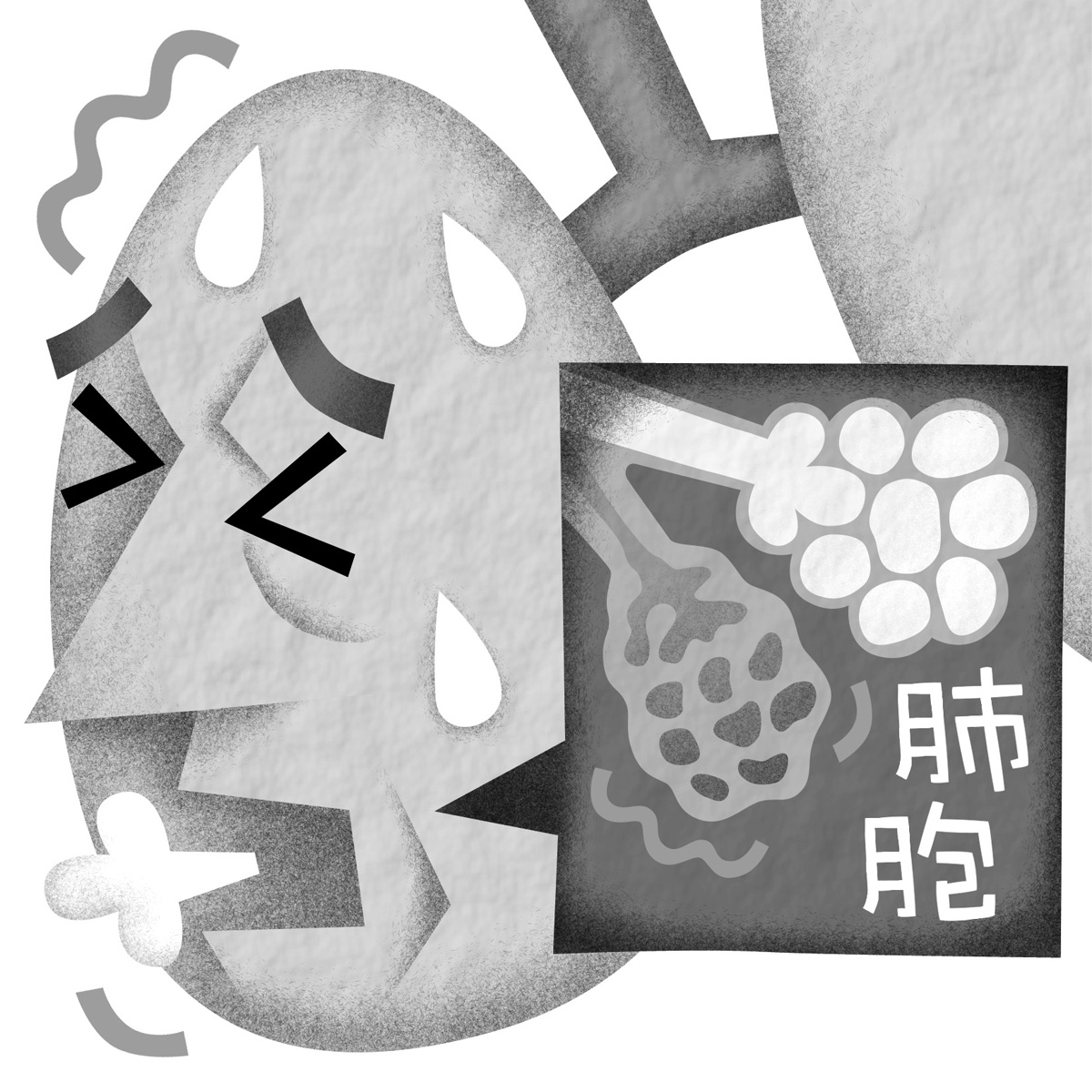 間質性肺炎・肺線維症と類縁疾患 (呼吸器疾患 診断治療