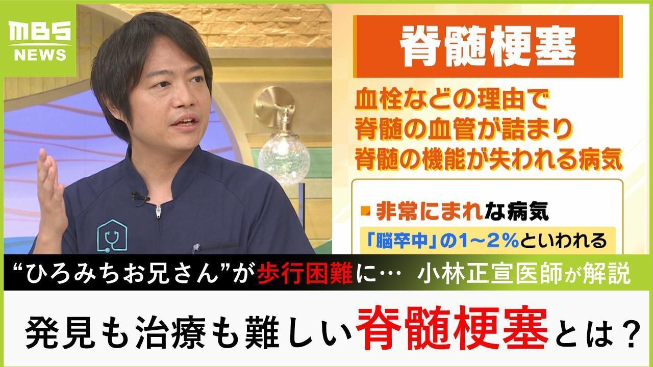 “ひろみちお兄さん”を襲った病『脊髄梗塞』医師が解説「症状は突然起こり、数分で進行」「発症から数時間以内なら血栓溶解療法もあるが...」（MBSニュース） - Yahoo!ニュース