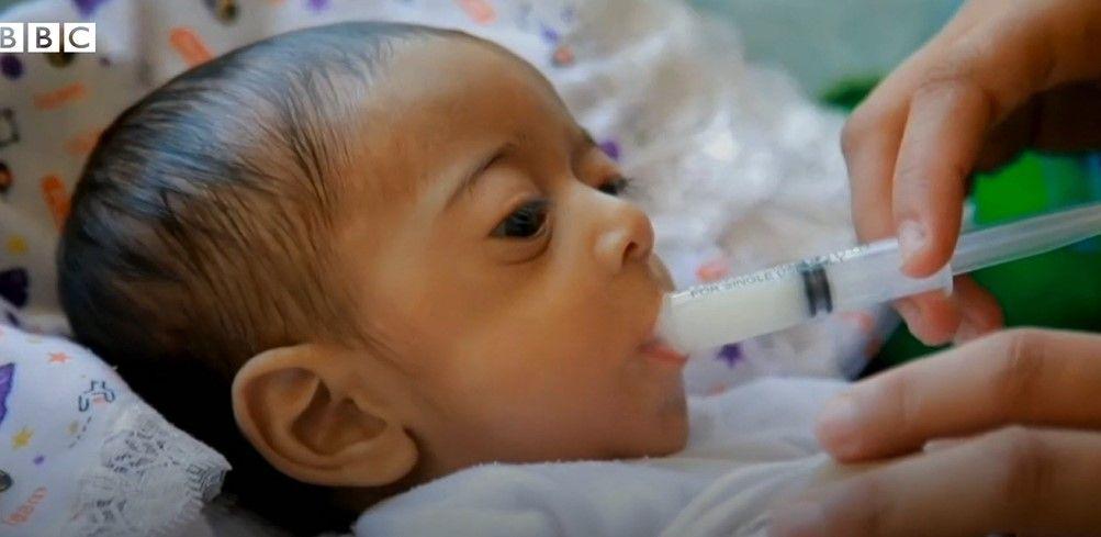 ガザの子供8000人超が急性栄養不良とWHO　粉ミルクの代わりにつぶした米（BBC News） - Yahoo!ニュース