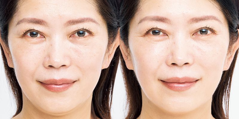 54歳の読者が試してみた!】「話題の美顔器」で顔はどこまで 54歳の読者が試してみた!】「話題の美顔器」で顔はどこまで