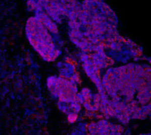 慢性腎臓病をiPS技術で治療 京大など、マウスで効果確認 数年以内に臨床試験目指す(Science Portal)