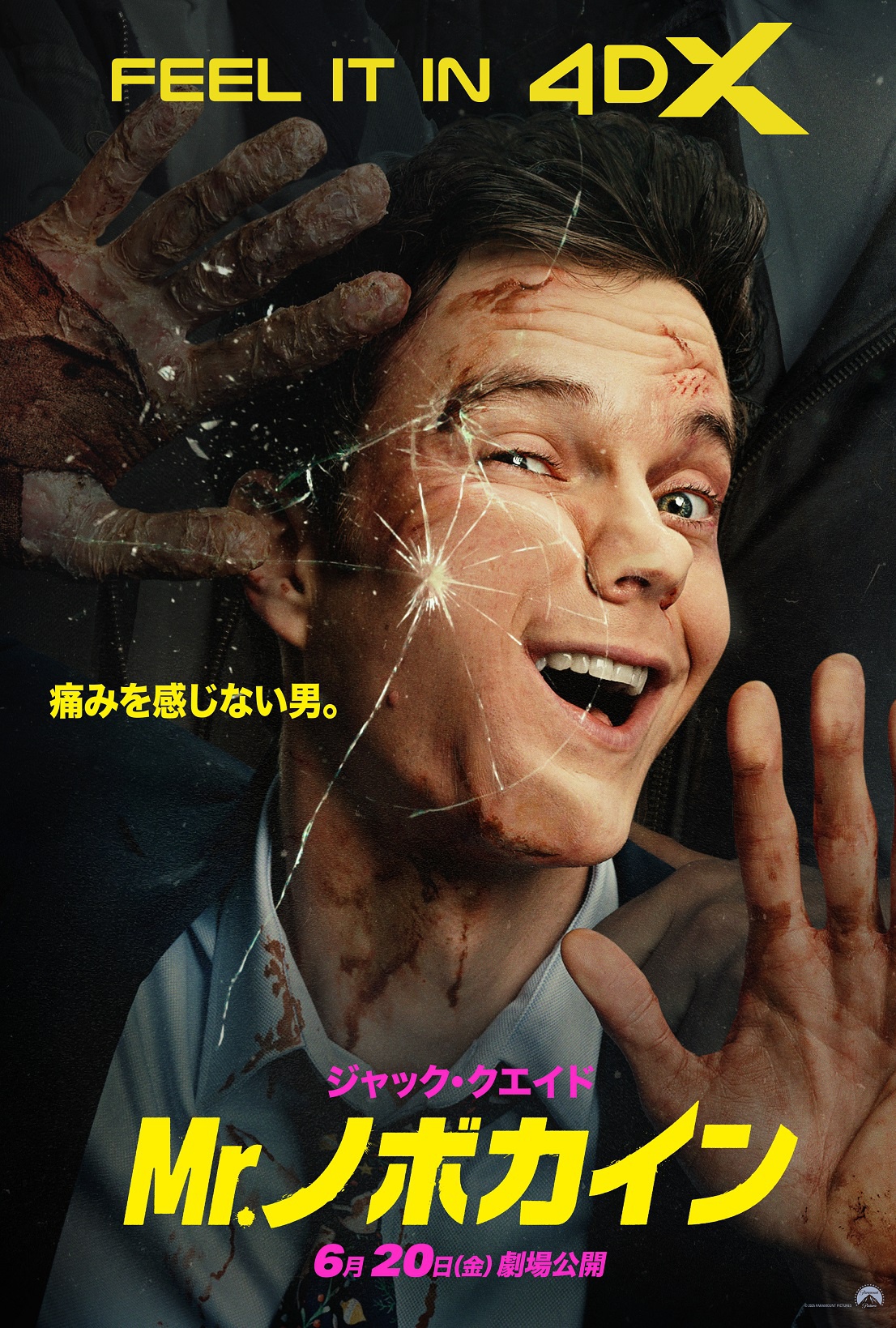 痛みを感じない男”の激痛アクションを4Dで体感！『Mr.ノボカイン