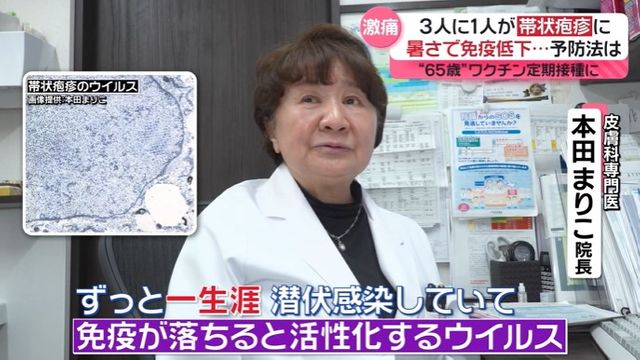 「二度と嫌。痛いなんてもんじゃない」3人に1人が「帯状疱疹」に…これからの季節は免疫力低下に要注意『every.特集』