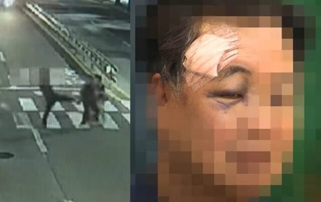 「悪口が聞こえた気がした」だけで“顔面キック”→骨折…韓国・信じがたい「路上暴行」衝撃映像 「悪口が聞こえた気がした」だけで“顔面キック”→骨折…韓国・信じがたい「路上暴行」衝撃映像