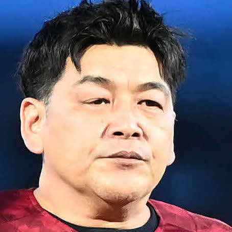 富澤たけしの腎臓の画像比較：2年前と最近の尿路結石の成長を示す矢印