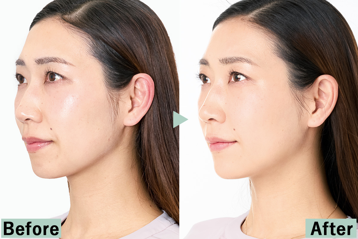 Before→After】「5分足らずで、5年前の笑顔を取り戻した」と