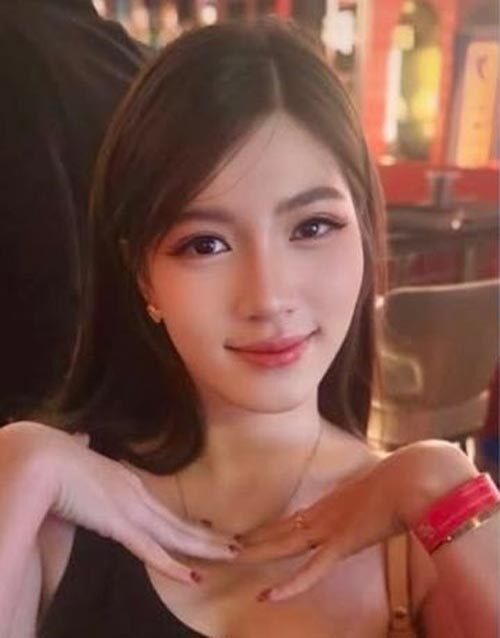 美容整形によるヒアルロン酸アレルギーで腫れたタイ人女性の唇