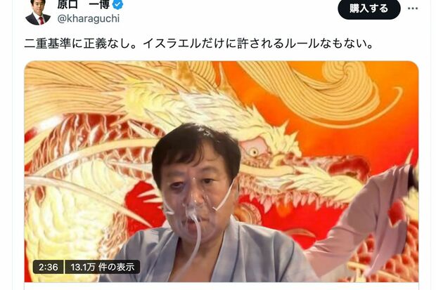 立憲民主党の原口一博衆議院議員、ベッドから転落し負傷した痛々しい姿（本人のX投稿より）