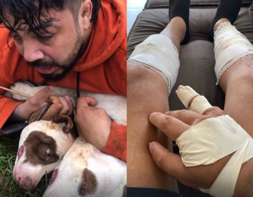ブラジルでピットブルに襲われ、脚部に複数の怪我を負った格闘家エルネストさん