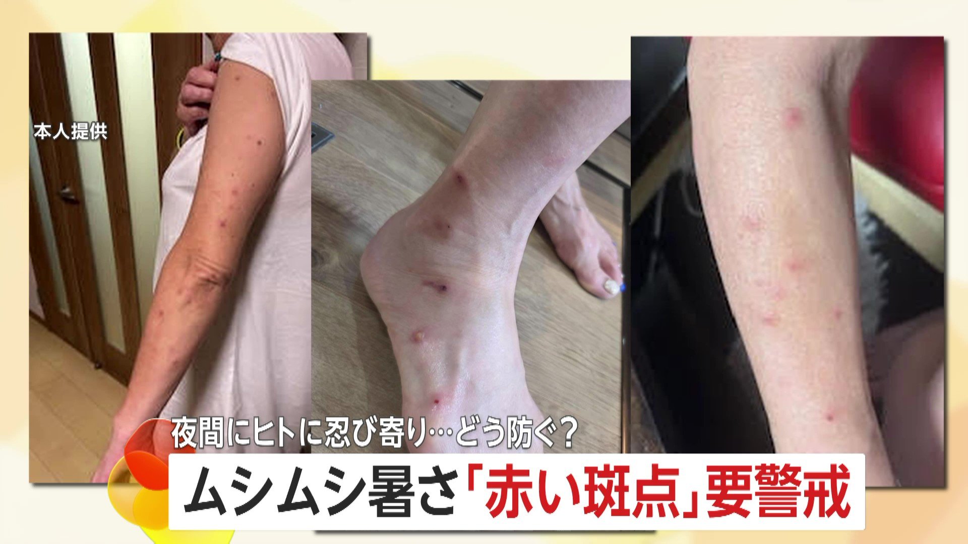 FNNプライムオンライン発 トコジラミ被害に関するニュース画像