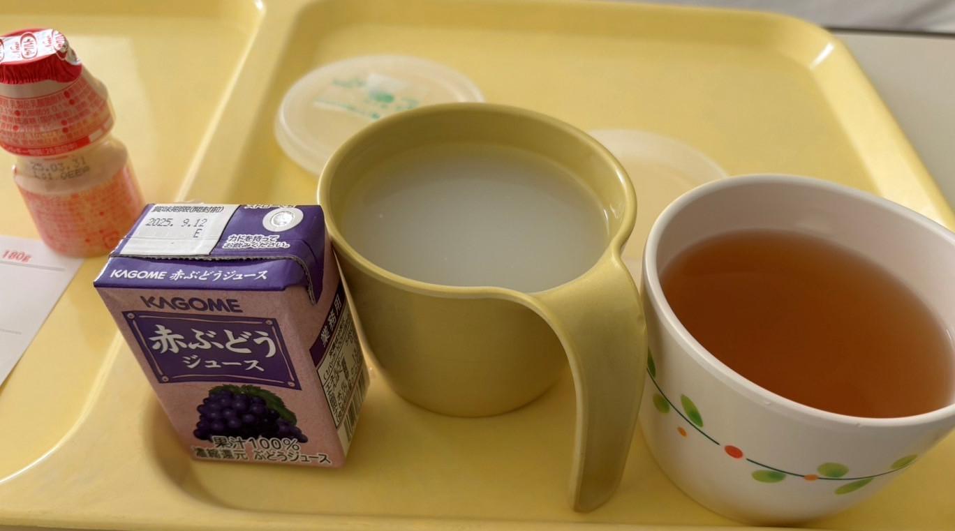 直腸がん手術後、回復期にある記者が病院で摂る流動食の朝食。重湯やスープなどが写っており、高額療養費制度の恩恵を感じさせる日々の風景。