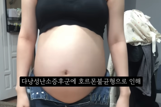 韓国の違法中絶事件で注目された、妊娠36週の胎児中絶を題材としたYouTuberのVlog映像