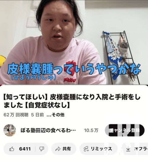 ぼる塾 田辺智加さんが卵巣腫瘍摘出手術について語る様子。健康意識向上と早期発見の重要性を伝える。