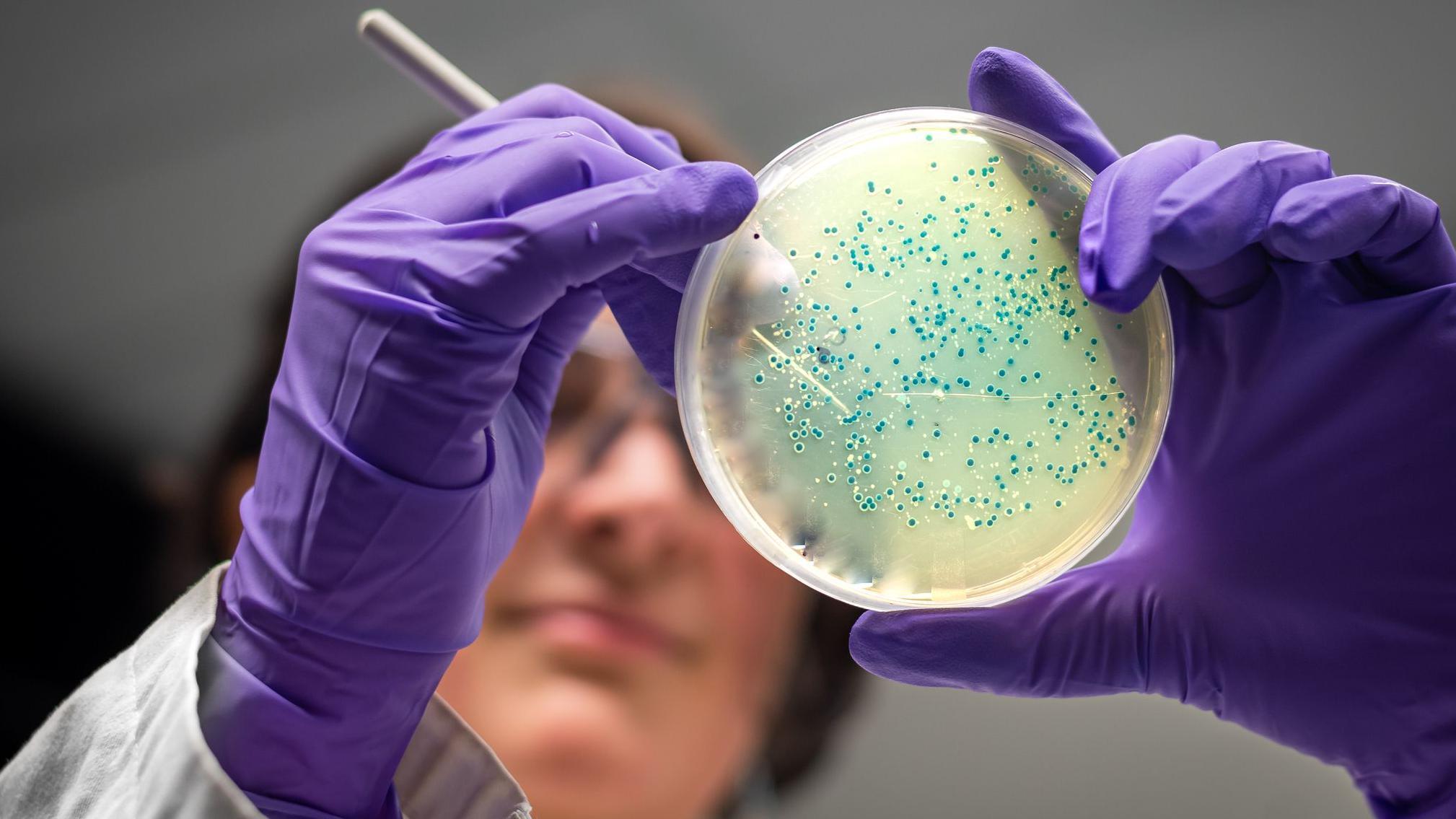 AIが設計した新抗生物質がスーパー耐性菌に作用する様子を示す概念図。分子構造と細菌の相互作用を視覚化したイメージ。