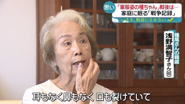 終戦直後、焼け野原となった皇居周辺の様子。田井種尾さんが顔と手の一部を失った焼夷弾による被害の深刻さを示す。