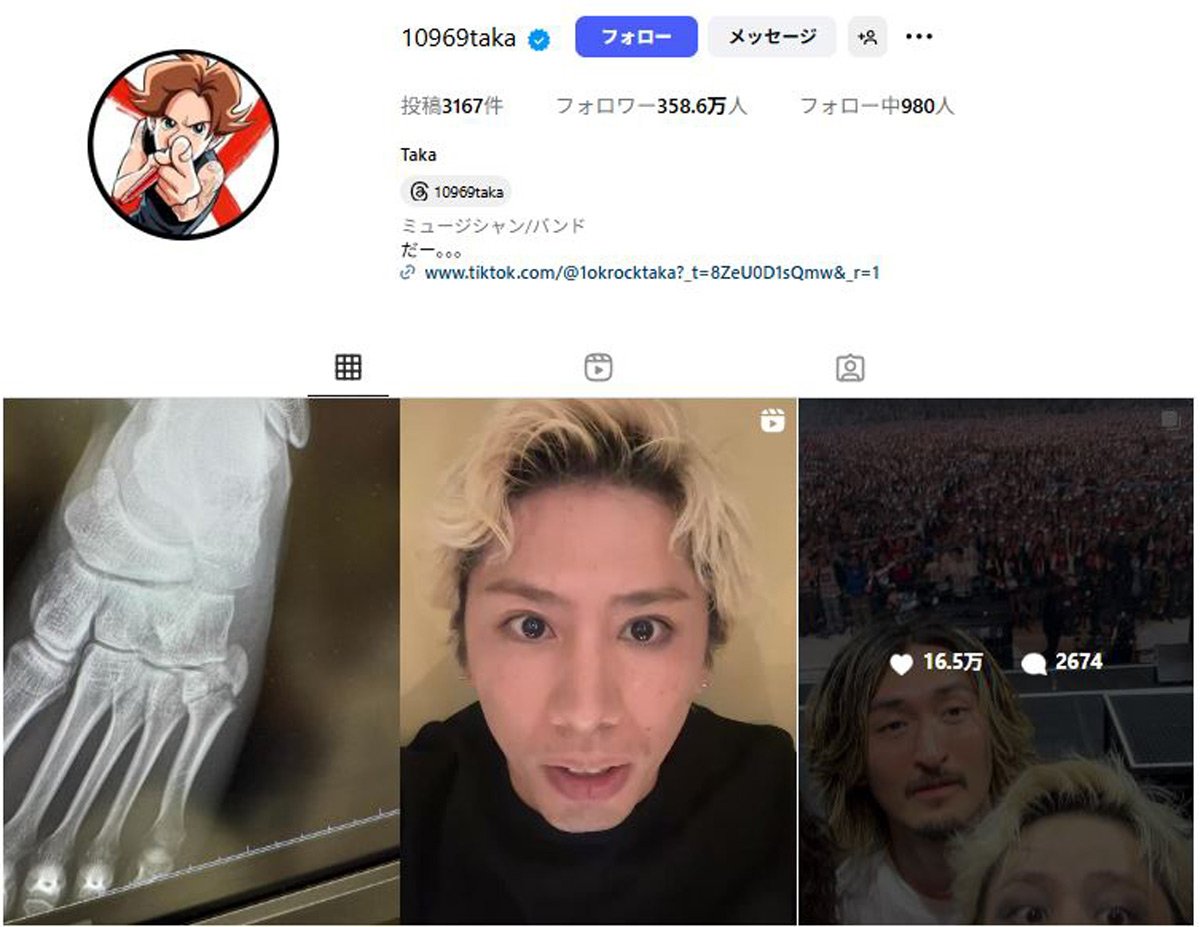 ONE OK ROCKボーカルTakaの真剣な表情。ライブでの負傷にも関わらずツアー続行の意向を示す。