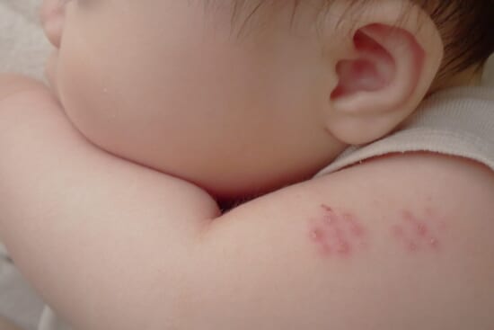 日本の医療問題を示すイメージ写真