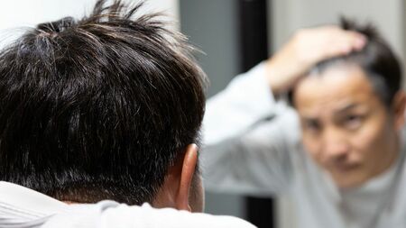 薄毛治療の新たな展開を示す顕微鏡画像