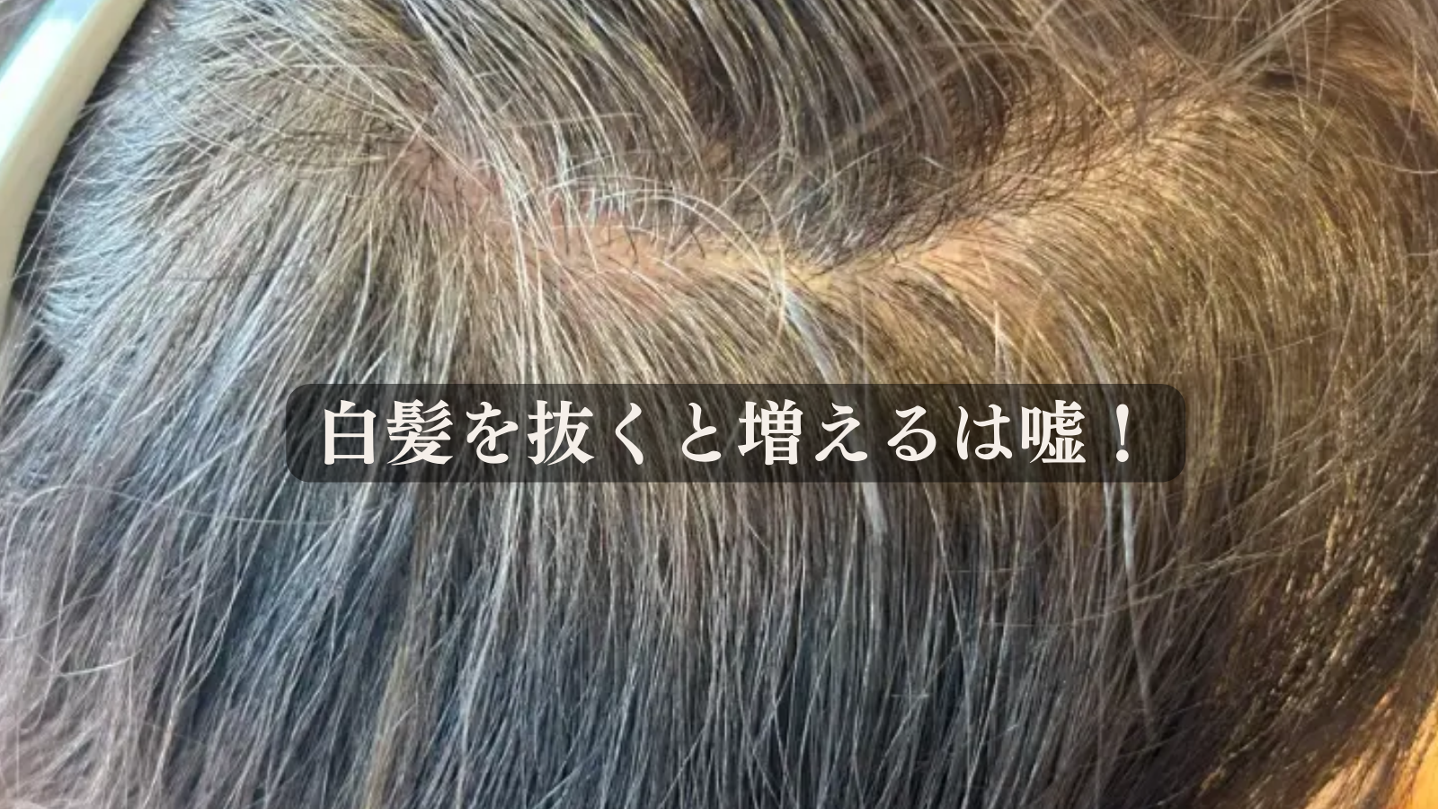 白髪 抜く と 増える