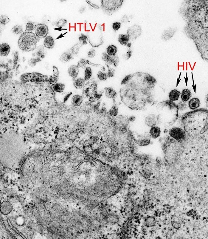 HIVとHTLV-1の電子顕微鏡画像（CDCライブラリより）