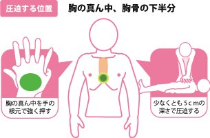 日本循環器学会 コール＆プッシュ　誰でもできる胸骨圧迫＋ＡＥDの蘇生法