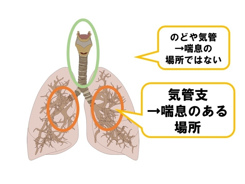 イラストACから筆者作成