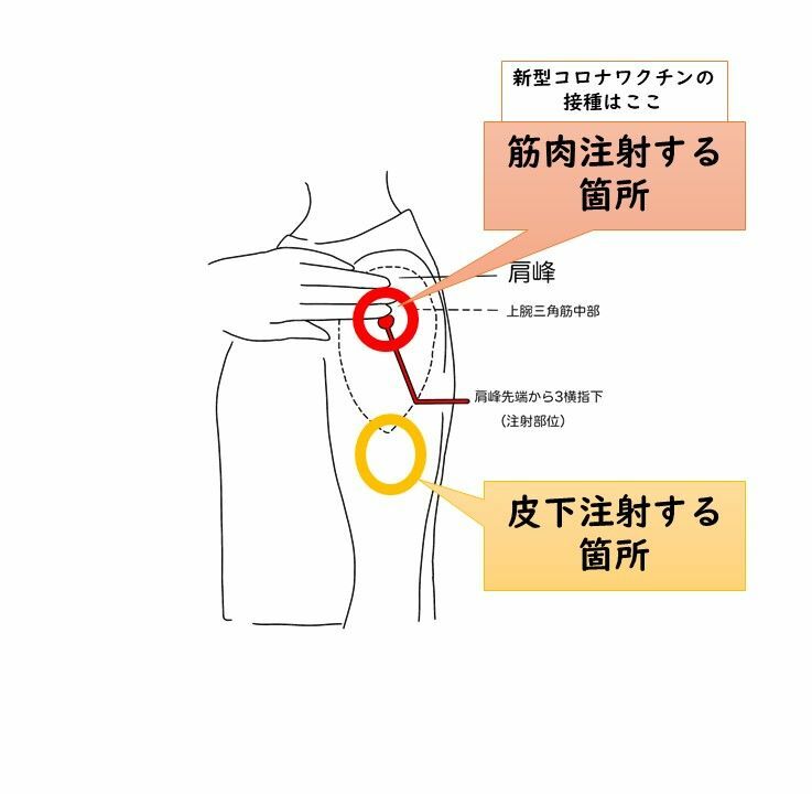 イラストACから筆者作成