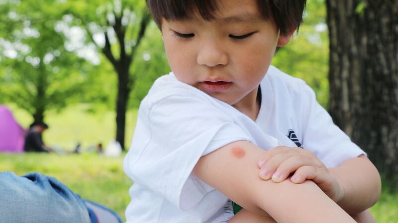 子どもの虫よけ どれを使ったら良いですか 堀向健太 個人 Yahoo ニュース 子どもの虫よけ どれを使ったら良いですか 堀向健太 個人 Yahoo ニュース