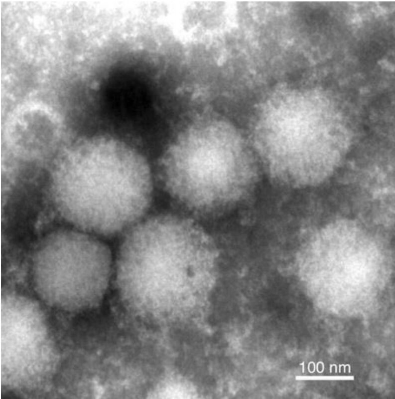 「エゾウイルス」の粒子の電子顕微鏡写真。北海道大学などのリリースより。