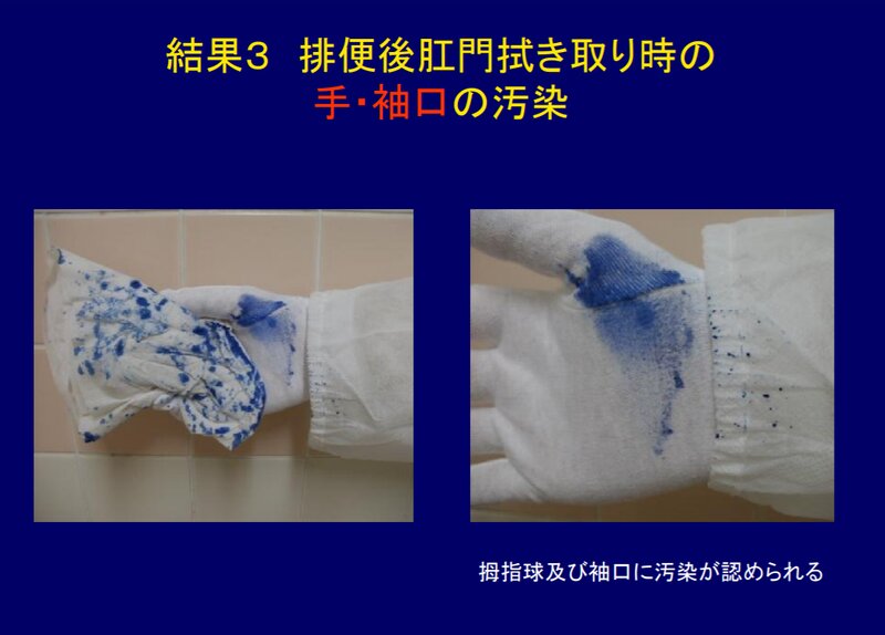 出典：「トイレを起点とするノロウイルス汚染拡大の検証」長野県北信保健福祉事務所