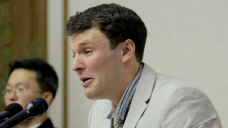 Yahoo!ニュース北朝鮮が拷問か…死亡の米大学生の歯列変形。米メディアが写真公開