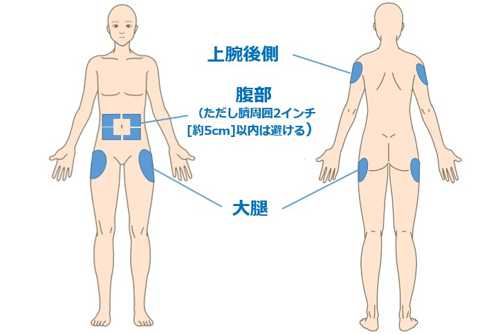 図3. 抗体カクテル療法の皮下注射部位（看護roo!より使用）