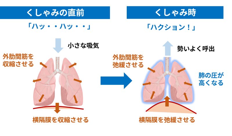 図1. くしゃみは肺に負担をかける（筆者作成）（イラストは看護roo!より使用）