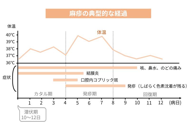 図1.麻疹の症状(筆者作成)