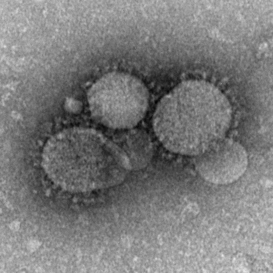 MERSコロナウイルス（Wikipediaより）