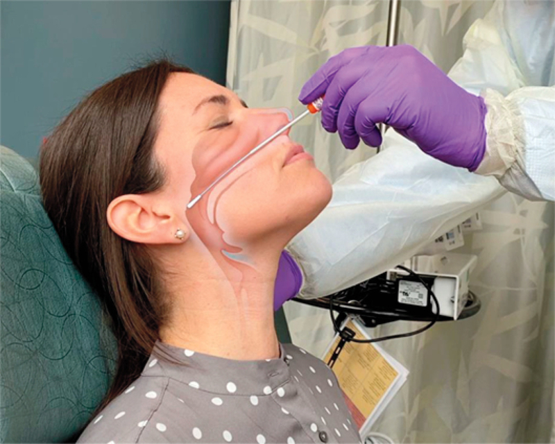 鼻咽頭拭い液の採取（NEJM. DOI: 10.1056/NEJMvcm2010260より）