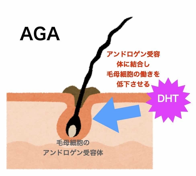 DHTとAGAとの関係(筆者作成)