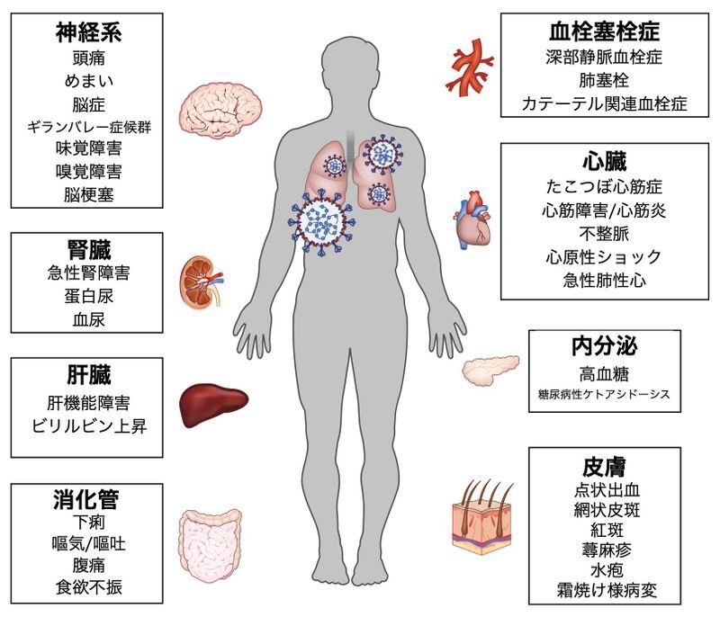 呼吸器以外の新型コロナの症状（Nat Med . 2020 Jul;26(7):1017-1032.）