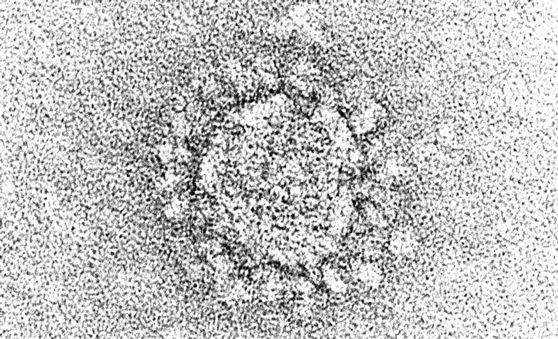 新型コロナウイルス（CDC.PHILより）