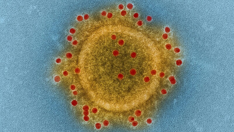 コロナ ばらまく と来店の男 逮捕には 壁 も 捜査の焦点は 追記あり 前田恒彦 個人 Yahoo ニュース コロナ ばらまく と来店の男 逮捕には 壁 も 捜査の焦点は 追記あり 前田恒彦 個人 Yahoo ニュース
