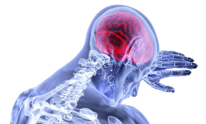 脳卒中は、脳の血管が破れたり詰まったりして脳がダメージを受ける病　画像：Pixabay