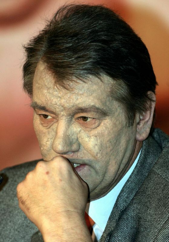 ウクライナ大統領選挙のやり直し投票直前のユシチェンコ（2004.12.4）。顔面の種痘が痛々しい。