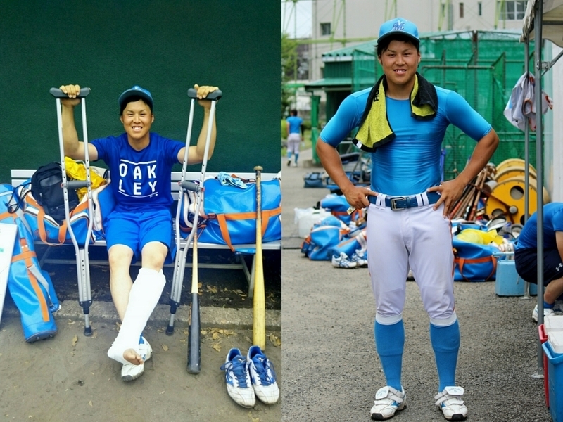 平井選手の経過報告！左足を痛めた日(左)と、その1週間後(右)。順調です！