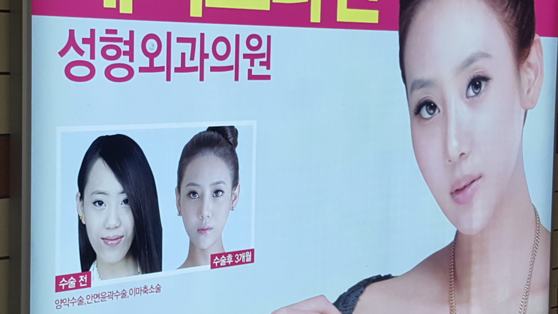 若い女性が二極化 過度なダイエットと整形トラブルが投影する韓国の 外見至上主義 慎武宏 個人 Yahoo ニュース